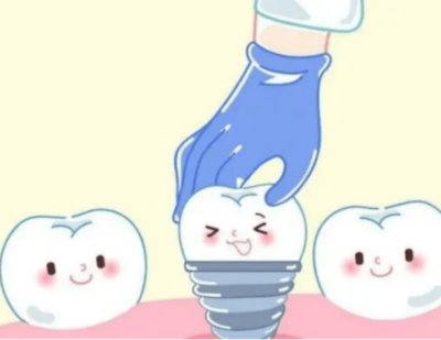 dentist advise for implant